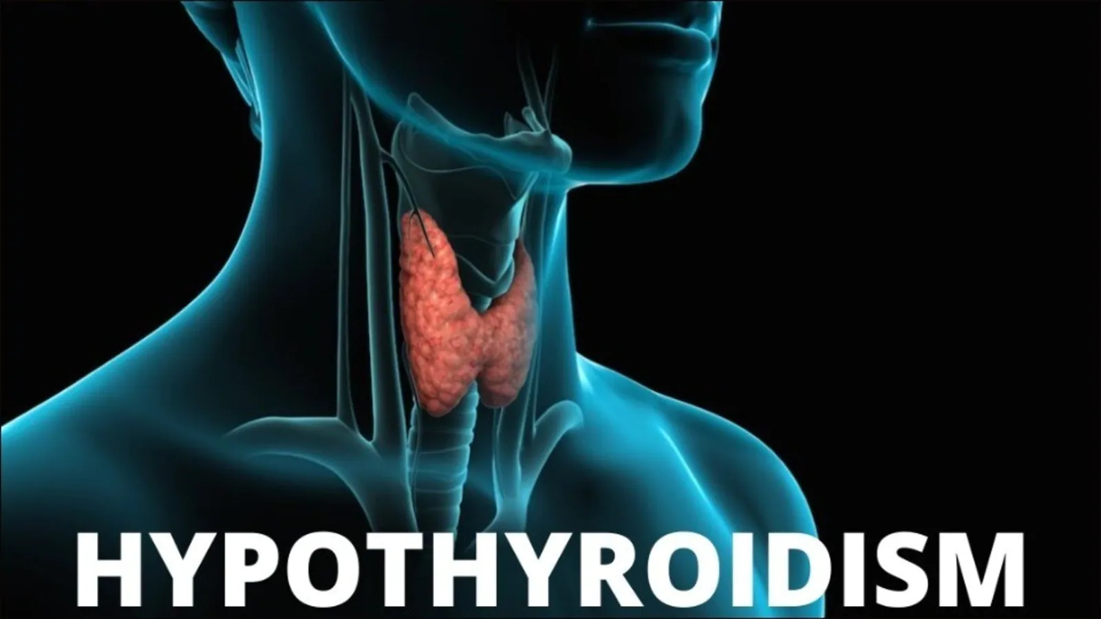 Thyroid ( hyper Hypo)